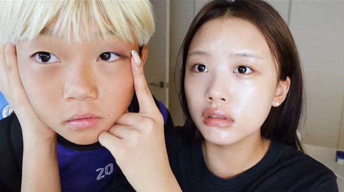 What's wrong with Lee Dong-guk's blackened eyes? (What time is it now?)? Let's do it again!)