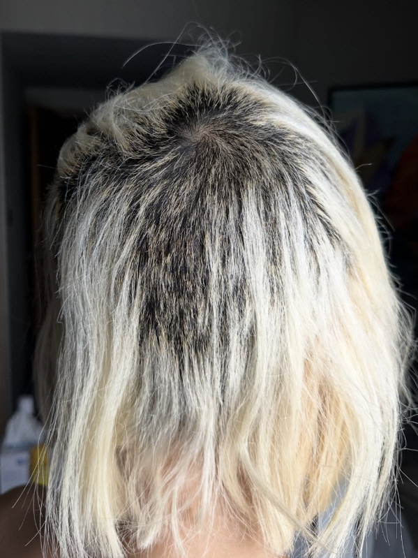 DJ Soda's hair condition is only 10% worse after bleaching accident 