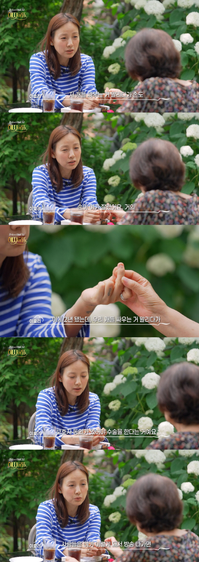 Lee Hyo-ri almost cut her hand while stopping a dog fight, and her nerves are cut off. 