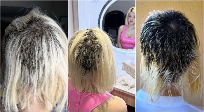  You look like an abused puppy...DJ Soda's Shocking Latest After Bleaching Accident, 10% of Hair Left