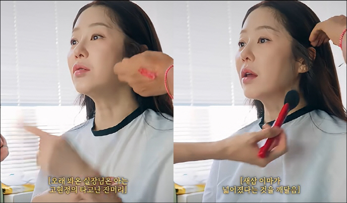 When asked if Ko Hyunjung planted her hair, her hair fell out and she's bald