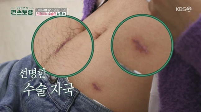 Nam Yoon-soo's kidney transplant → Recent state of injury...A deep scar is love