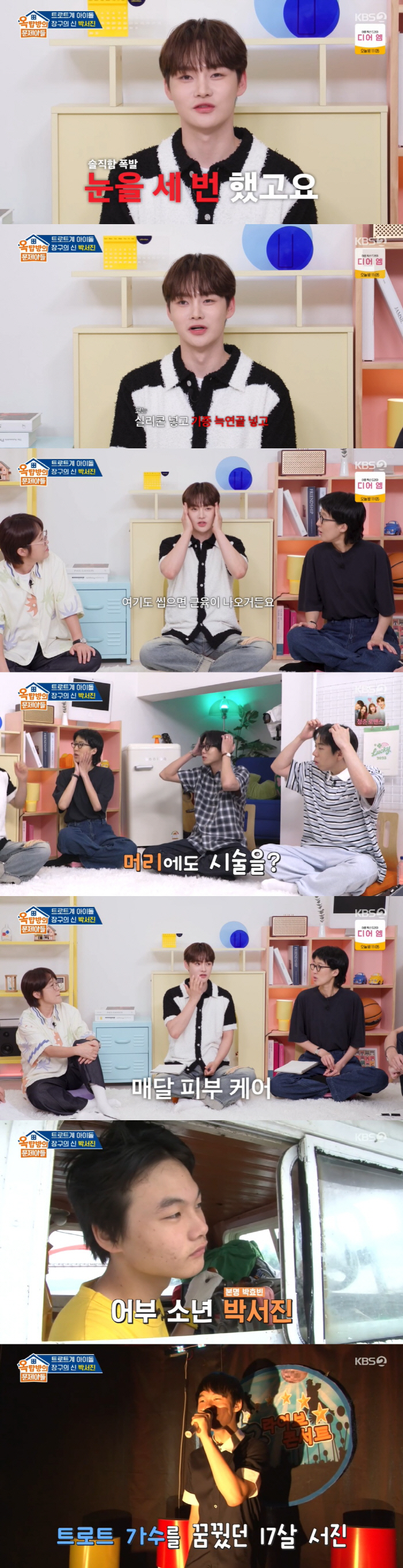 Park Seo-jin confesses to faceoff plastic surgery 3 times → From head and jaw Botox (Ok Moon-ah) 