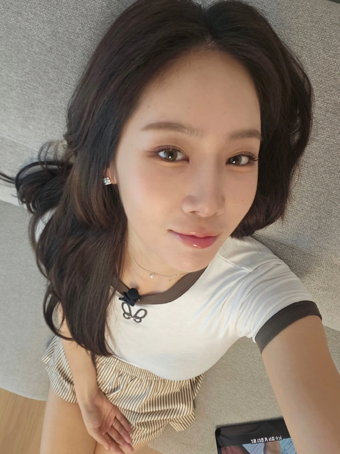 Soyou succeeded in losing 10kg for a completely changed appearance that sparked rumors of plastic surgery