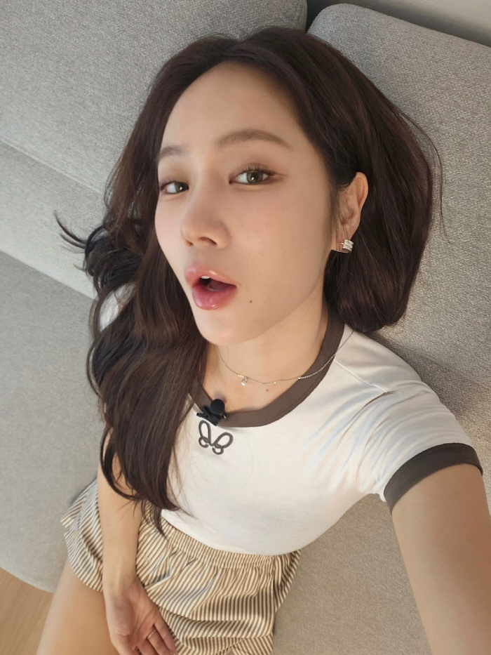Soyou succeeded in losing 10kg for a completely changed appearance that sparked rumors of plastic surgery