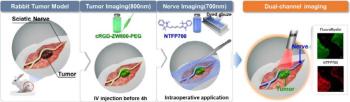 Development of the world's first simultaneous nerve and tumor identification imaging technique...New Standard for Precision Surgical Surgery