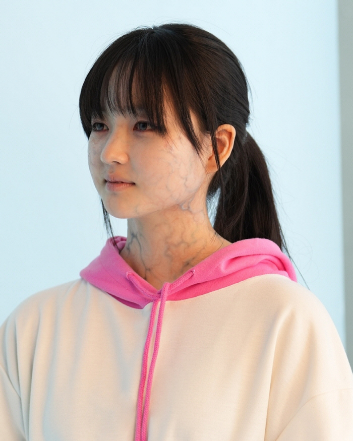 It's lovely even if I keep looking at it...Choi Yuri, how was the process of transforming into a zombie daughter