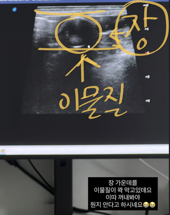 Mija to diagnose intestinal obstruction Swallows 1.5cm of foreign substances in dog laparotomy, make sure to save it