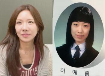 No. 13 for plastic surgery, No. 8 for eyes, No. 3 for nose, and No. 1 for chest and contour..It's not pretty even now