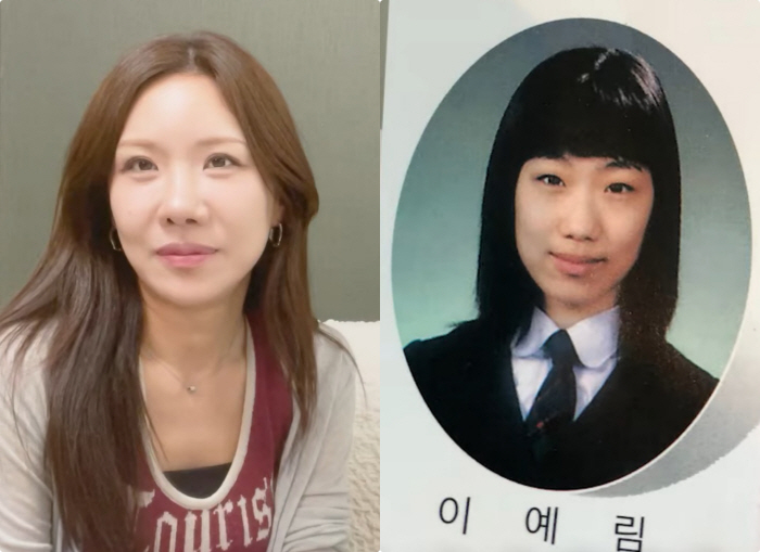 No. 13 for plastic surgery, No. 8 for eyes, No. 3 for nose, and No. 1 for chest and contour..It's not pretty even now