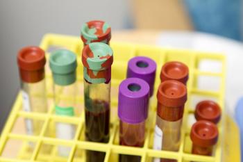 Preoperative blood and CT information can predict the risk of recurrence of gallbladder cancer