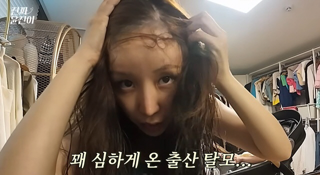 Yunjin's hair is gone due to childbirth and hair loss..It's crazy. It's serious