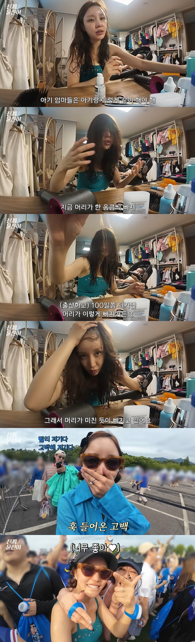 Yunjin's hair is gone due to childbirth and hair loss..It's crazy. It's serious