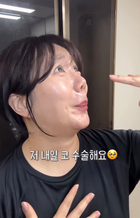Huh Anna's heart is upset because she's crooked when she raises her nose that had undergone re-surgery surgery