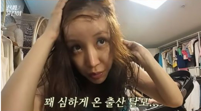 Yoon Jin-yi, who was blinded by hair loss after giving birth, cried and laughed during the 'Blank Show' ('Real Yoon Jin')