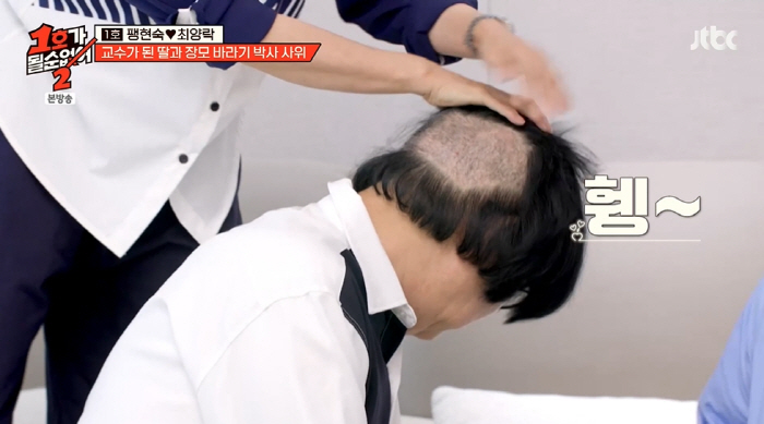 Hair transplant Choi Yang-rak planted 5,000 hairs exposed on the back of his injured head before his son, a prestigious university (No. 1)