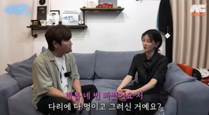 Lee Hyun, who lost her toenail No. 4, received industrial accident insurance