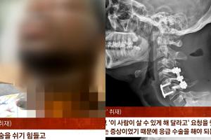 A model who 'broken her neck' while filming a commercial..'There's no apology, let alone reward'