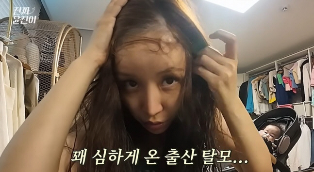 Yunjin reveals shocking hair loss condition after giving birth to two daughters Tears as their hair falls out in handfuls