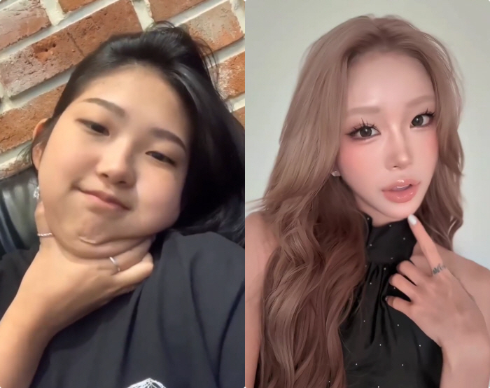 Choi Jin-sil's daughter Choi Jun-hee has been spreading my pictures on the Internet since birth, so I don't hide my plastic surgery