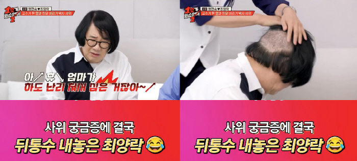 Choi Yang-rak is embarrassed in front of the forced disclosure of his head after a hair transplant (No. 1)