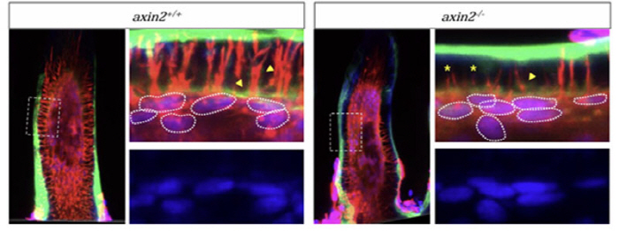 Determination of Genetic Causes of Slow and Hardening Teeth Growth
