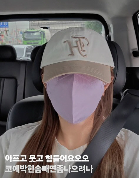 Lee Yong-gyu ♥ Yoo Ha-na's cheap nose. Reoperation after 20 years due to the fact-effect of her nose