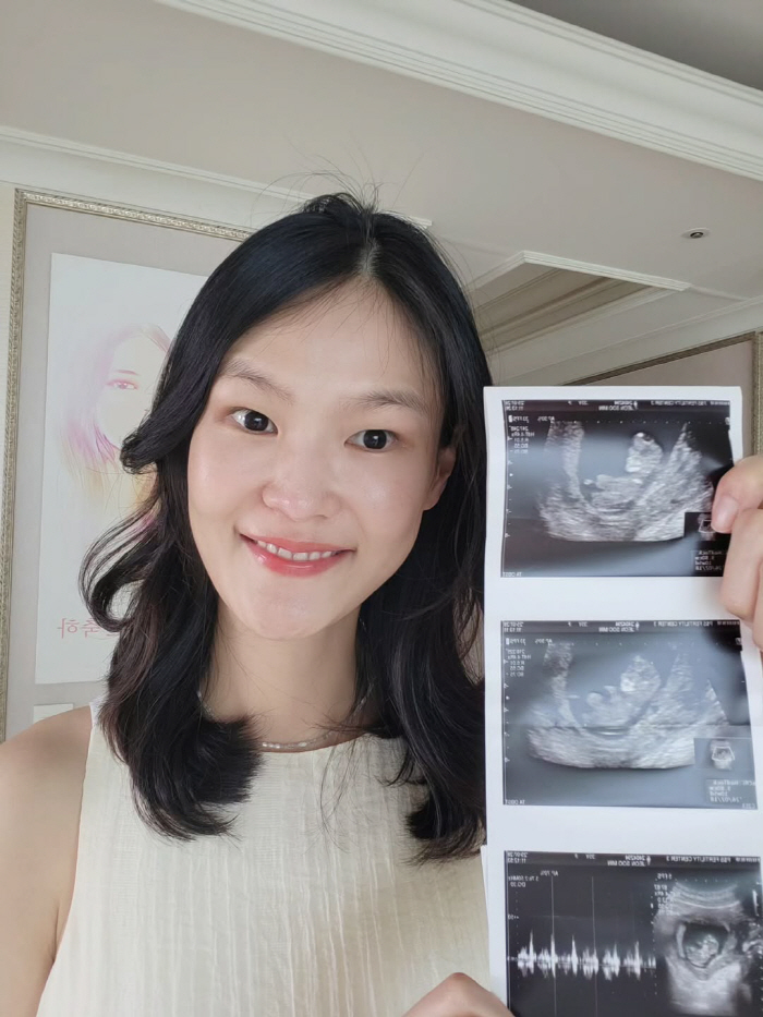 Kim Kyung-jin ♥ Jeon Soo-min becomes twin pregnant parents after 5 years of marriage