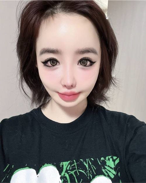 Park Bom, red bloodshot eyes...We stopped promoting 2NE1 too. 