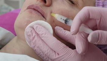 I got plastic surgery to stop my husband from cheating on me, but the side effects are serious