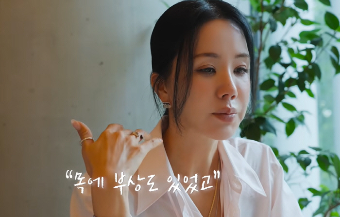 Thyroid cancer surgery Uhm Jung-hwa wanted to sit back and cry on the concert day