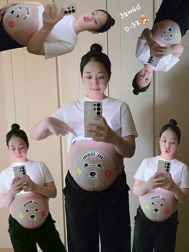 Park Bo-mi is pregnant with her son for 2 years..All-time symptoms include rib pain and reflux esophagitis