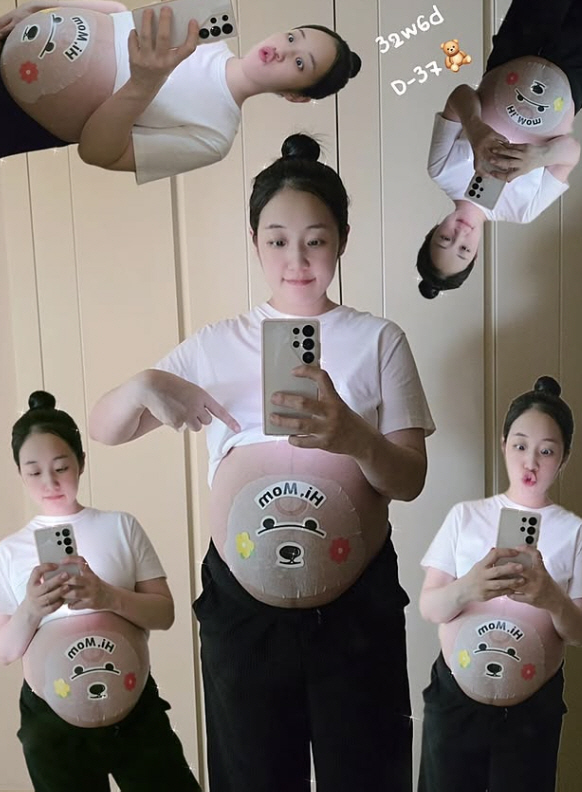 Park Bo-mi has one more face on the full-term D-line...Pigmentation  Pregnant Symptoms 