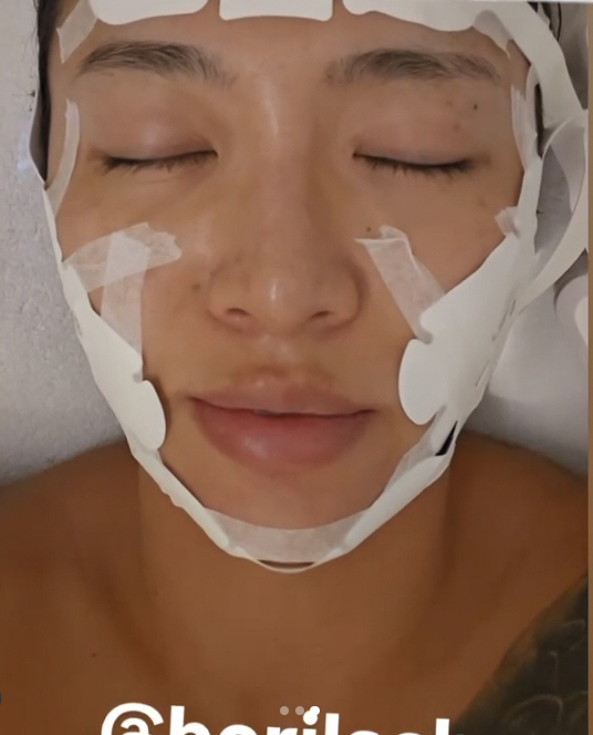 Lalal, with a bandage on her face, the hospital..'There's a car accident.' A bomb confession with her best friend