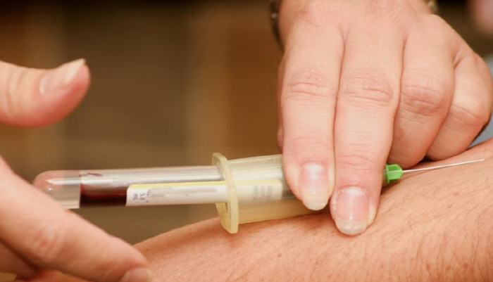 Sleeping woman fainted and then blood was drawn...The reason for the bizarre crime is absurd