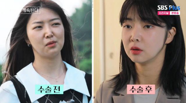 After breaking up with Young-ja, Mr. Hwang, you don't have to hide your eye and nose plastic surgery