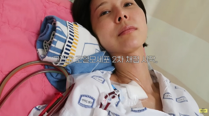 Kim Na-young, ♥I'm scared of donating hematopoietic stem cells amid support for MyQ's kiss, but I feel like I've been chosen (No Filter TV)