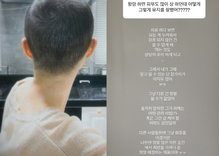Park Sung-kwang ♥ Lee Sol, cancer-fighting disease After chemotherapy, all hair loss and skin becomes black