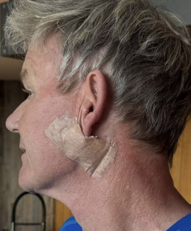 Gordon Ramsay Confesses to Fight Skin Cancer, Must Apply Sunscreen 