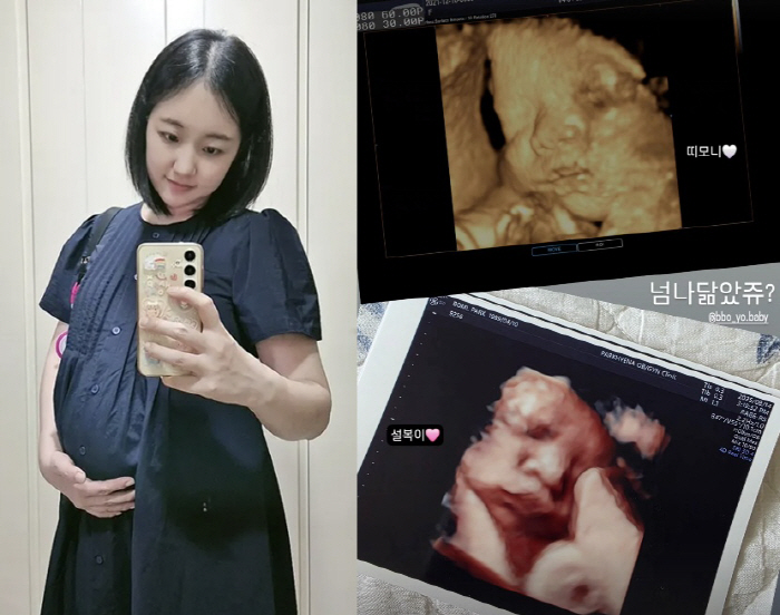 Park Bo-mi, who is pregnant after her son's image, is moved by ultrasound and looks so much like the first child