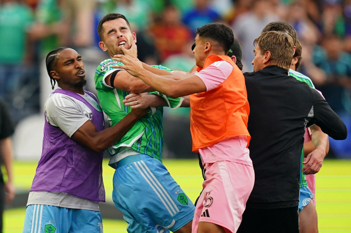 Personality does not change, Suarez, who lost his temper and spat on officials...behavior after the crushing defeat of the shock