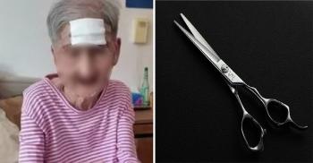 A 98-year-old grandmother who cut off the 4cm horn on her forehead by herself, almost got in big trouble...