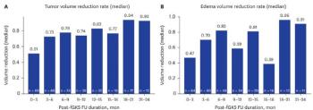 Large epilepsy cancer, fractional gamma knife radiation surgery effective...80% reduction in tumor and edema volume