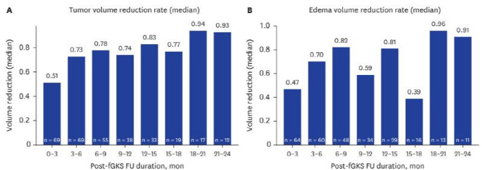 Large epilepsy cancer, fractional gamma knife radiation surgery effective...80% reduction in tumor and edema volume