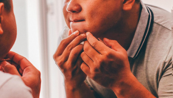 I thought it was pimple... Bumpy lumps and bumps. Why you shouldn't squeeze them out