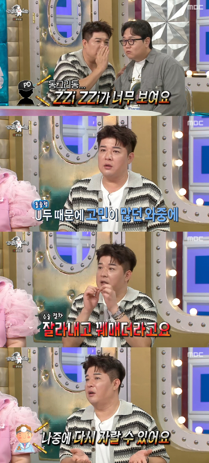 Shindong confesses to nipple-reducing surgery, and Nifle patch doesn't work..You can grow back