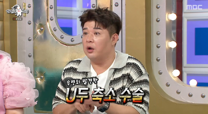 Shindong underwent shock body confession papillary reduction surgery... It can grow again