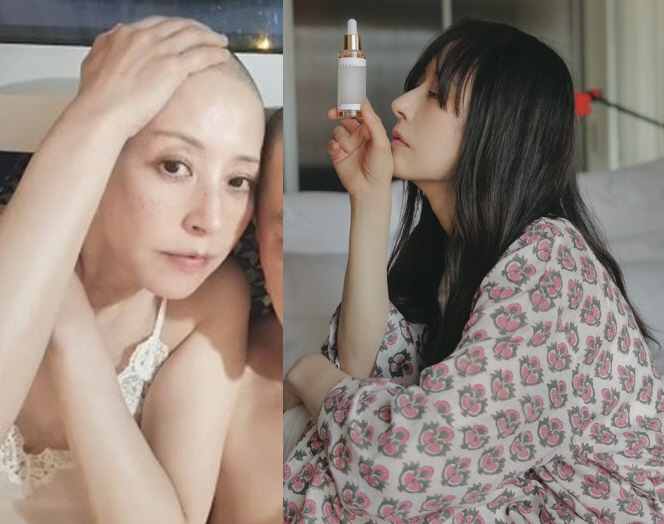 Seo Jeong-hee lost all her hair in chemotherapy, but what's surprising after overcoming breast cancer