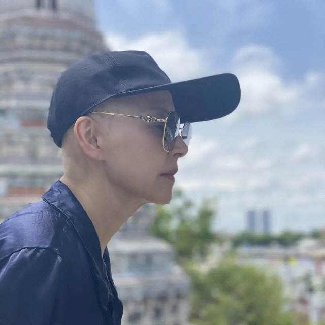 Seo Jeong-hee lost all her hair in chemotherapy, but what's surprising after overcoming breast cancer