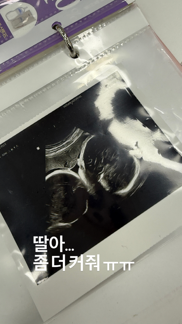 Twin pregnancy Ji So-yeon, please grow a little bigger on her small daughter in her sad tears